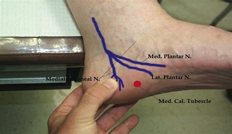 Calcaneal Nerve