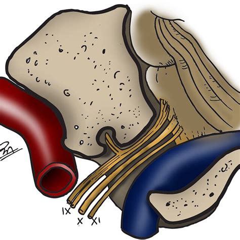 (A) Schematic showing the three portions of the petrous segment of the ...