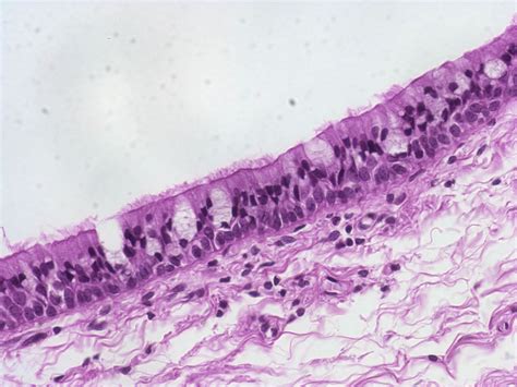 Pseudostratified Columnar Epithelium: Description: Single layer of ...