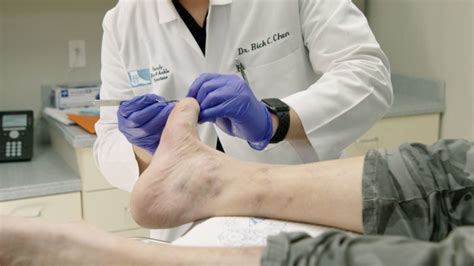 Debridement - Family Foot and Ankle Care of Greenville