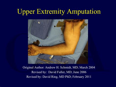 Upper Limb Amputee