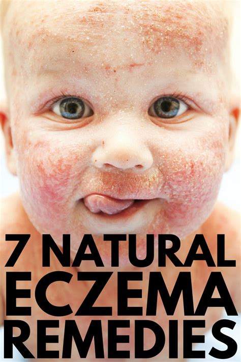 If you're on the hunt for eczema remedies that work quickly and effectively in treating dry ...