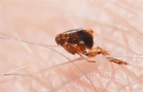 Fleas In Human Hair: Treatments And Home Remedies