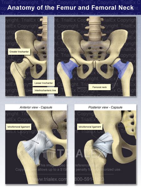 Anatomy of the Femur and Femoral Neck - Trial Exhibits Inc.