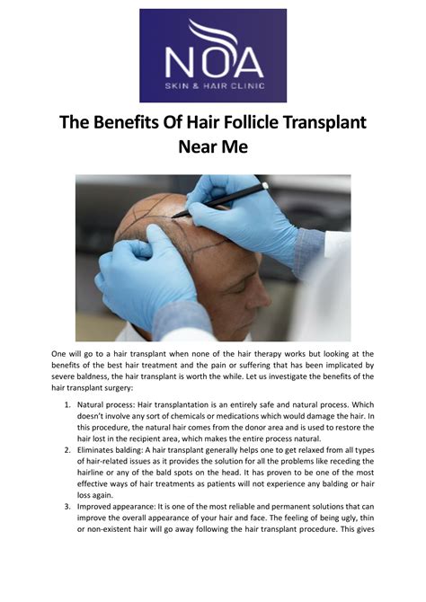 PPT - The benefits of hair follicle transplant near me PowerPoint Presentation - ID:12000630