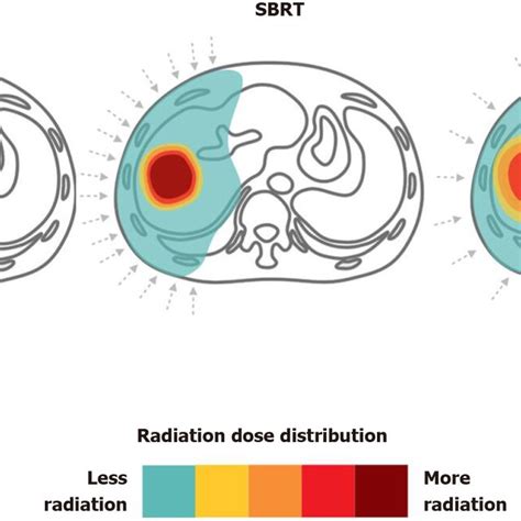 Proton therapy vs stereotactic body radiation therapy vs conventional ...