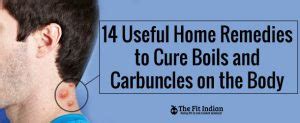 14 Powerful Natural Remedies for Painful Boils and Carbuncles