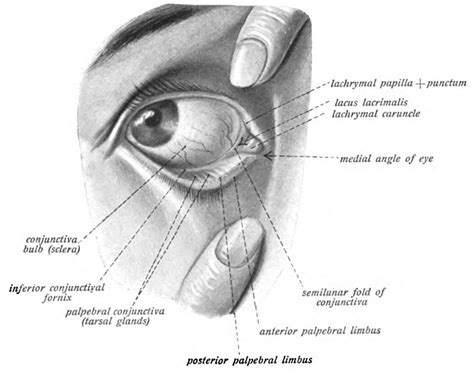 Conjunctivitis — Taming the SRU