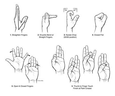 10+ images about OT : Hand, Splinting on Pinterest | Shoulder injury ...