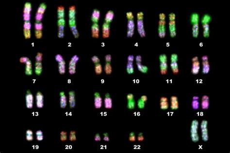 Homologous Chromosomes - Definition and Example