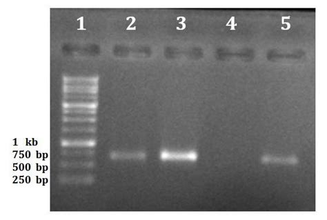 Colony-PCR. Colony-PCR of the DH5α transformants was performed with ...