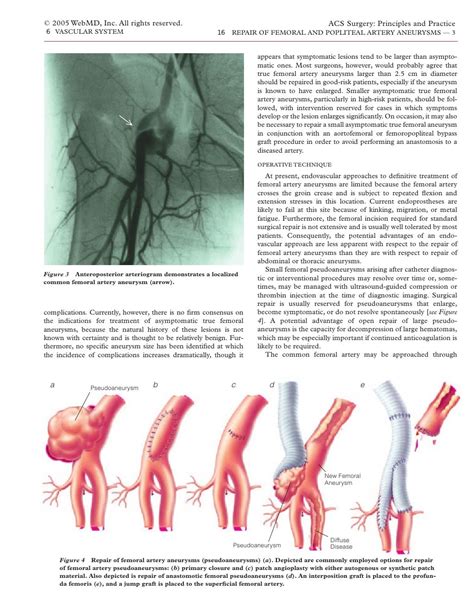 Acs0616 Repair Of Femoral And Popliteal Artery Aneurysms