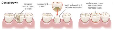 Biomimetic Dentistry | Natural Dentist | Integrative Dental Solutions