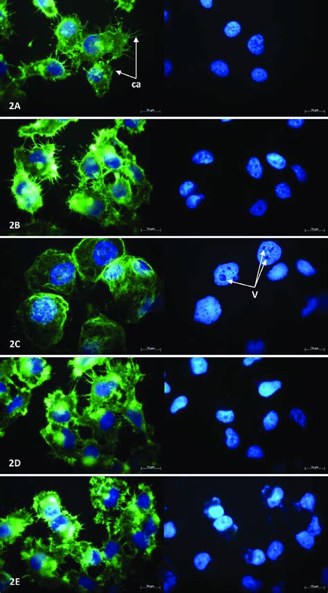 MCF-7 cell morphology following 24-hours exposure to anti-angiogenic ...