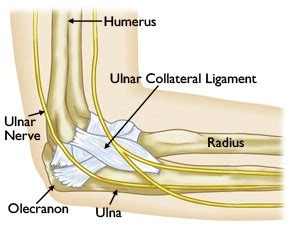 UCL Injuries of the Elbow | Beacon Orthopaedics & Sports Medicine