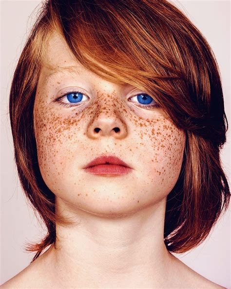 #Freckles - Unique Portrait Series Showing Beauty Of Freckled ...