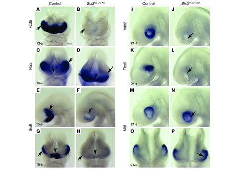 Expression of typical optic vesicle markers is missing or defective in... | Download Scientific ...