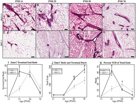 Akt1 mediates the terminal end bud, terminal duct and alveolar bud ...