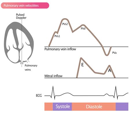 Assessment of diastolic function by echocardiography – Cardiovascular Education