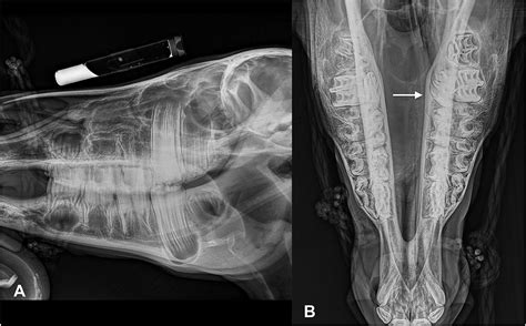 Frontiers | Diagnosis and Surgical Treatment of Idiopathic Primary Sino ...