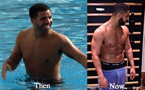 Drake Plastic Surgery Before and After Photos