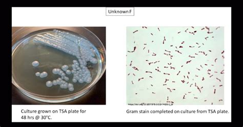 select the two unknown bacterial species that your unknown could be based off of your gram stain ...