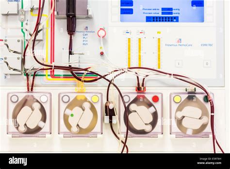 Exchange Transfusion Machine