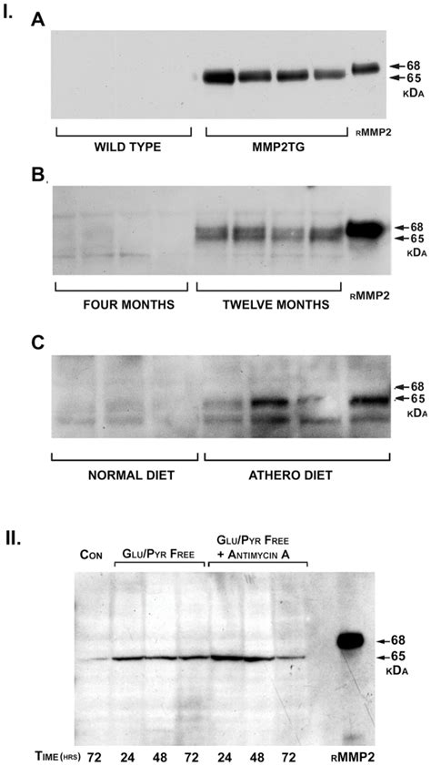 I. A. Western blot analysis for MMP-2 expression in... | Download ...