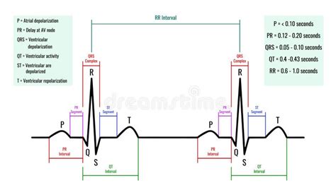 Illustration of ECG Interpretation. ECG of a Healthy Person.Useful for Educating Doctors and ...