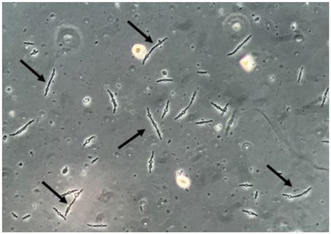 JoF | Free Full-Text | Urine Sediment Findings and the Immune Response to Pathologies in Fungal ...