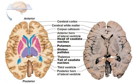 Basal ganglia, Basal ganglia anatomy, Brain anatomy