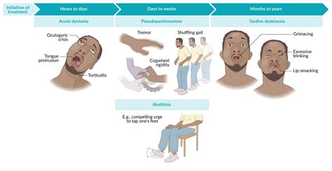 Extrapyramidal Syndrome