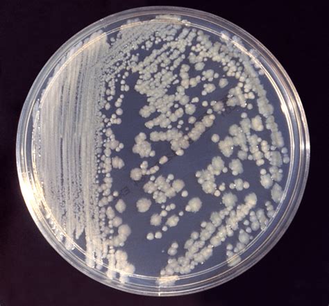 Multidrug Resistant Organisms: One of Health Care's Killers