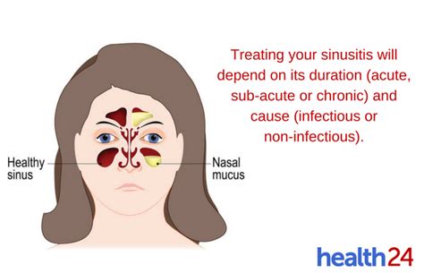 Are you using the correct treatment for your sinusitis? | Health24