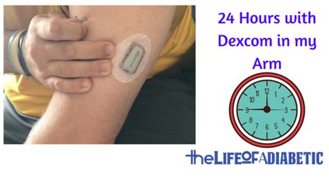 24 Hours with a Dexcom Arm Site | Inserting Dexcom into Your Arm