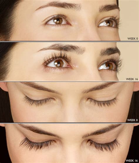 Orange County Latisse Eyelash Growth | Gentle Touch