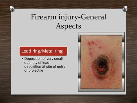 Firearm injuries_Forensics