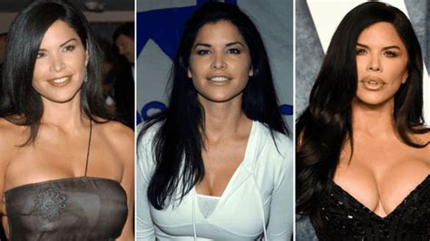 Lauren Sanchez Plastic Surgery: Before and After Photos