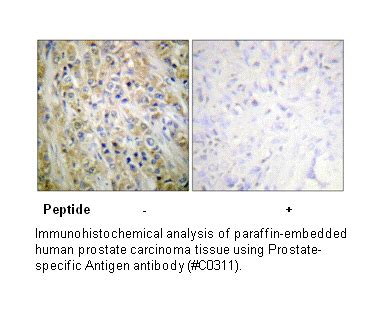 Prostate-specific Antigen Antibody | AAT Bioquest