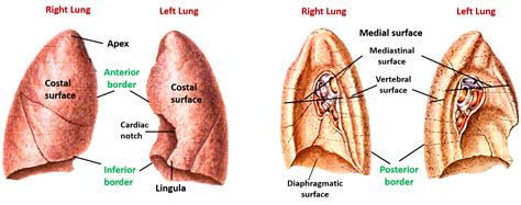 Lungs – Anatomy QA