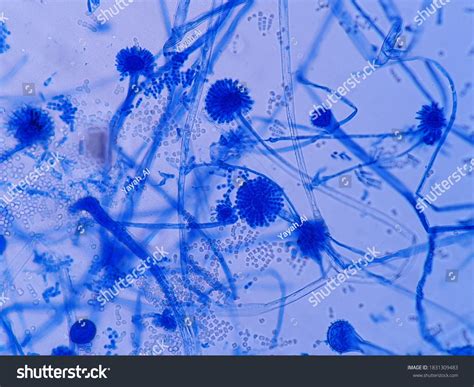 Aspergillus Conidiophores Gram Stain