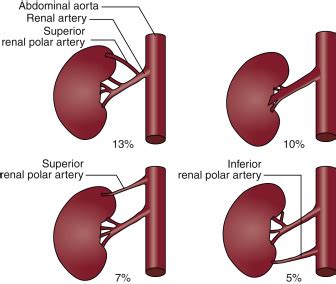 Renal Artery