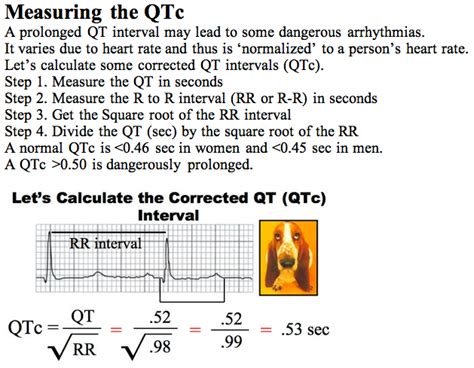 QT Interval Corrected Measurement