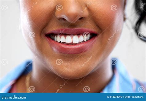 Close Up of African American Woman White Teeth Stock Image - Image of ...