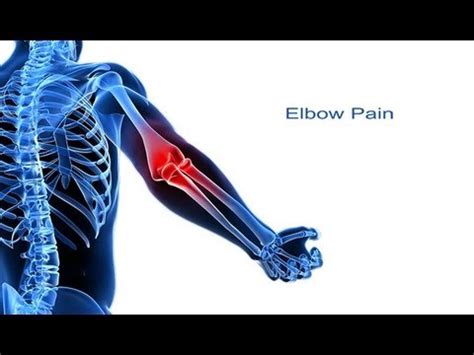 5 Steps to Elbow Pain Relief | Ruhul Amin