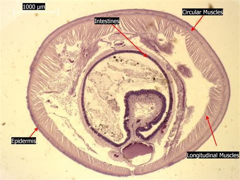 Free photo: Earthworm Under Microscope - Annelida, Study, Structures - Free Download - Jooinn