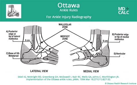 Ottawa Ankle Rule - MDCalc | Physical therapy education, Nursing jobs ...