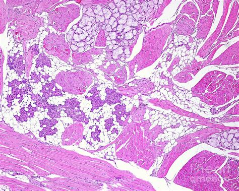 Mucous And Serous Glands Photograph by Jose Calvo/science Photo Library ...