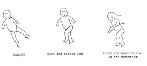 Optical Righting Reflex Infants