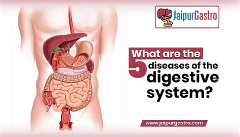 What are the 5 diseases of the digestive system?